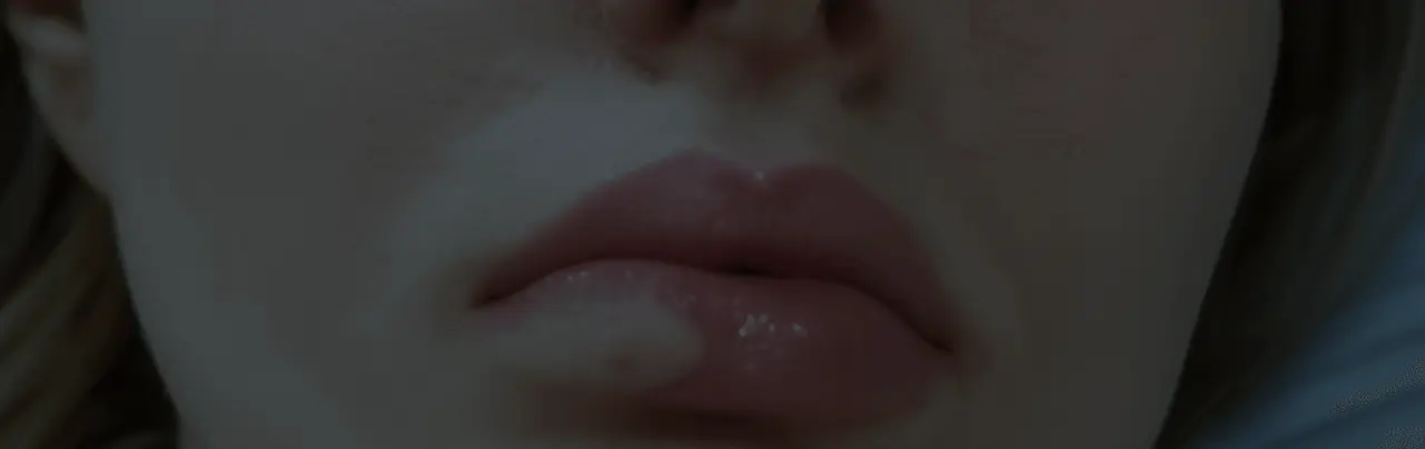 complications of botox example photo