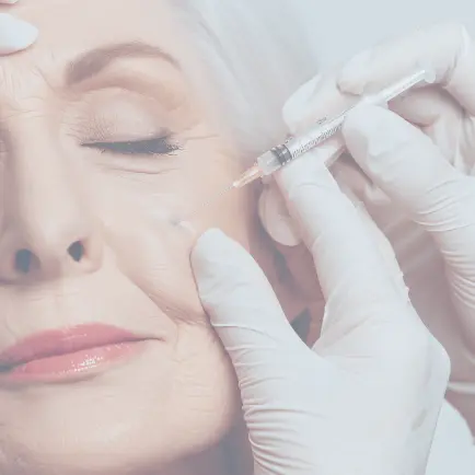 facial fillers photo