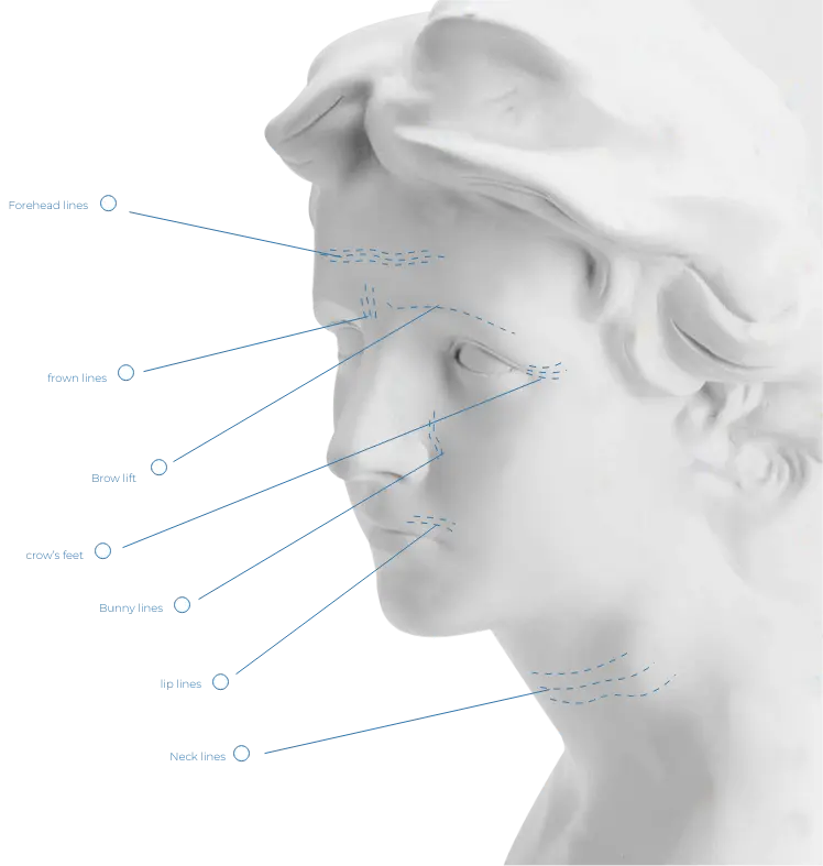 injection techniques illustration